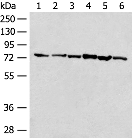 Western blot analysis of 293T cell K562 cell lysates  using TCF25 Polyclonal Antibody at dilution of 1:250