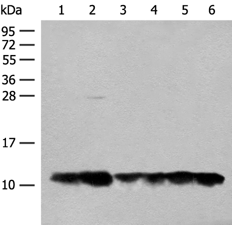 Western blot analysis of 293T cell Human fetal liver tissue lysates  using ATP5L Polyclonal Antibody at dilution of 1:500