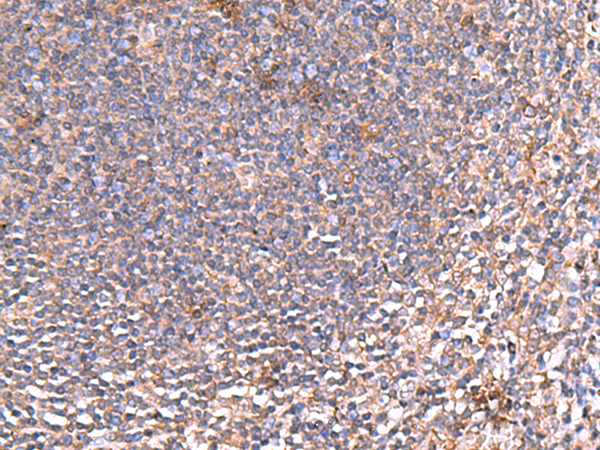 Immunohistochemistry of paraffin-embedded Human tonsil tissue  using PDRG1 Polyclonal Antibody at dilution of 1:80(×200)