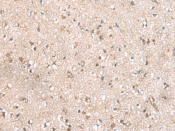Immunohistochemistry of paraffin-embedded Human brain tissue  using RPL23A Polyclonal Antibody at dilution of 1:50(×200)