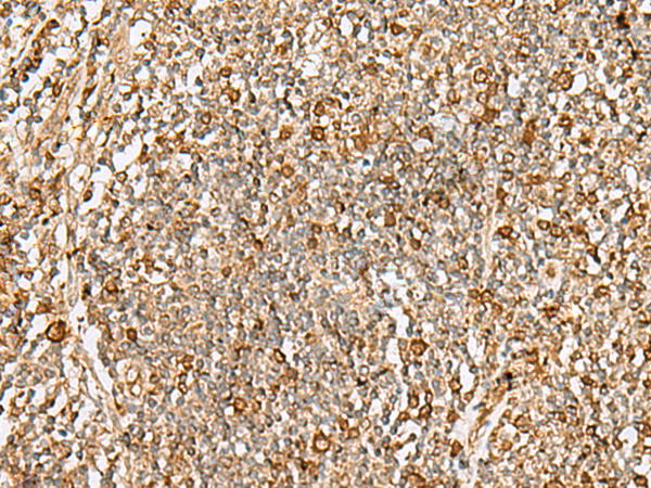 Immunohistochemistry of paraffin-embedded Human tonsil tissue  using DTYMK Polyclonal Antibody at dilution of 1:70(×200)