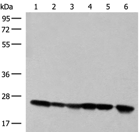 Western blot analysis of 293T cell and Human fetal liver tissue lysates  using DTYMK Polyclonal Antibody at dilution of 1:550