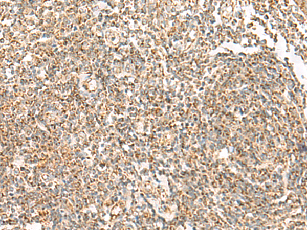 Immunohistochemistry of paraffin-embedded Human tonsil tissue  using ORC4 Polyclonal Antibody at dilution of 1:70(×200)