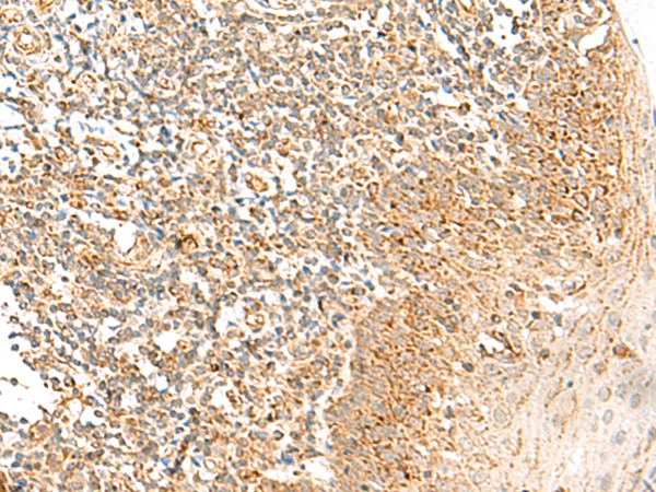 Immunohistochemistry of paraffin-embedded Human tonsil tissue  using MRPS18B Polyclonal Antibody at dilution of 1:35(×200)