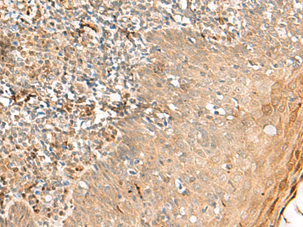 Immunohistochemistry of paraffin-embedded Human tonsil tissue  using ZNF397 Polyclonal Antibody at dilution of 1:45(×200)