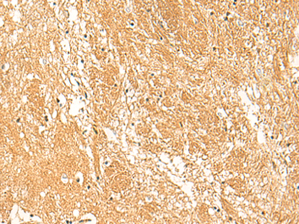 Immunohistochemistry of paraffin-embedded Human brain tissue  using STK32C Polyclonal Antibody at dilution of 1:30(×200)