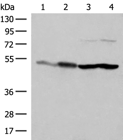 Western blot analysis of Mouse brain tissue HepG2 A375 Hela cell lysates  using FLOT2 Polyclonal Antibody at dilution of 1:350