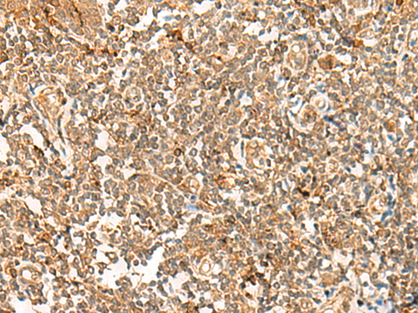 Immunohistochemistry of paraffin-embedded Human tonsil tissue  using POLR1E Polyclonal Antibody at dilution of 1:40(×200)