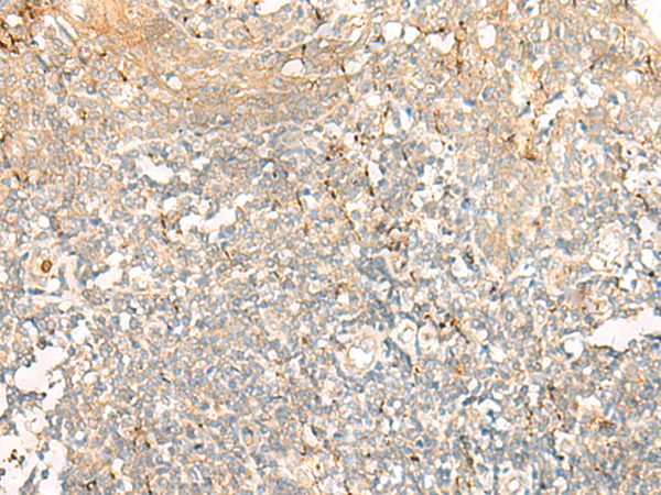 Immunohistochemistry of paraffin-embedded Human tonsil tissue  using GCAT Polyclonal Antibody at dilution of 1:60(×200)