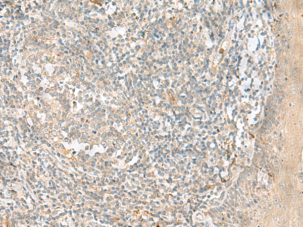 Immunohistochemistry of paraffin-embedded Human tonsil tissue  using TTLL1 Polyclonal Antibody at dilution of 1:90(×200)