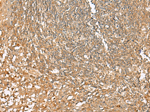 Immunohistochemistry of paraffin-embedded Human tonsil tissue  using SCRN2 Polyclonal Antibody at dilution of 1:50(×200)