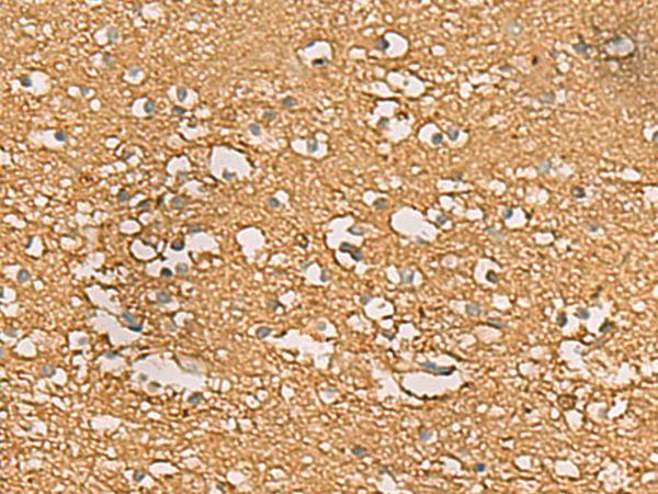 Immunohistochemistry of paraffin-embedded Human brain tissue  using ENO3 Polyclonal Antibody at dilution of 1:70(×200)