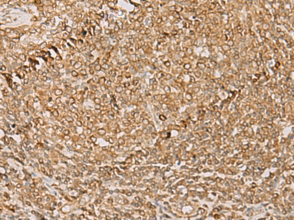 Immunohistochemistry of paraffin-embedded Human tonsil tissue  using PSMD12 Polyclonal Antibody at dilution of 1:50(×200)