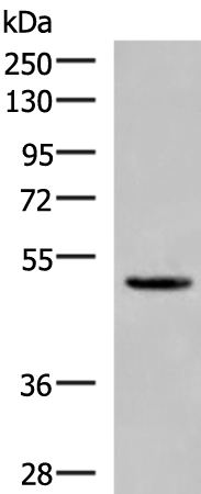 Western blot analysis of Human cerebrum tissue lysate  using PSMD12 Polyclonal Antibody at dilution of 1:900