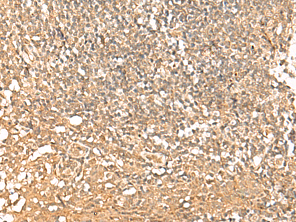 Immunohistochemistry of paraffin-embedded Human tonsil tissue  using PWP1 Polyclonal Antibody at dilution of 1:50(×200)