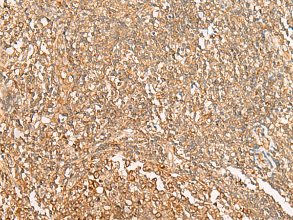 Immunohistochemistry of paraffin-embedded Human tonsil tissue  using NARS Polyclonal Antibody at dilution of 1:30(×200)