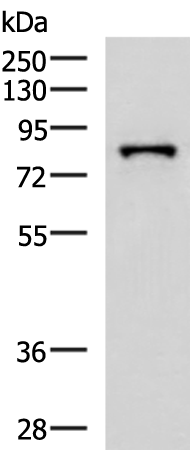 Western blot analysis of HepG2 cell lysate  using PRPF3 Polyclonal Antibody at dilution of 1:2000