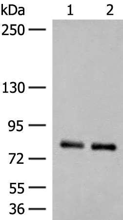Western blot analysis of Rat brain tissue and Mouse brain tissue lysates  using NGEF Polyclonal Antibody at dilution of 1:250