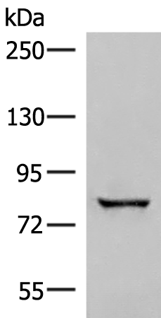 Western blot analysis of Human bladder transitional cell carcinoma grade 2-3 tissue lysate  using TTC12 Polyclonal Antibody at dilution of 1:300