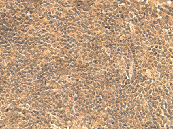 Immunohistochemistry of paraffin-embedded Human tonsil tissue  using FAM186B Polyclonal Antibody at dilution of 1:25(×200)