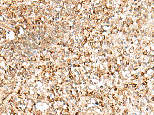 Immunohistochemistry of paraffin-embedded Human tonsil tissue  using TEX11 Polyclonal Antibody at dilution of 1:50(×200)