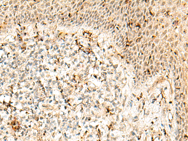 Immunohistochemistry of paraffin-embedded Human tonsil tissue  using RBM15 Polyclonal Antibody at dilution of 1:50(×200)