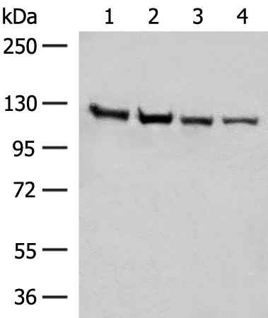 Western blot analysis of Human fetal brain tissue K562 cell Hela and A172 cell lysates  using IPO11 Polyclonal Antibody at dilution of 1:450