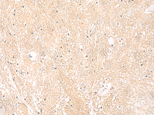 Immunohistochemistry of paraffin-embedded Human brain tissue  using EMC1 Polyclonal Antibody at dilution of 1:35(×200)