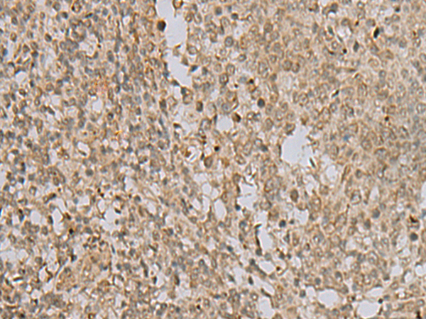 Immunohistochemistry of paraffin-embedded Human tonsil tissue  using LYRM1 Polyclonal Antibody at dilution of 1:40(×200)