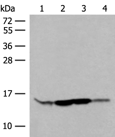 Western blot analysis of HL60 Hela 231 cell Human breast cancer tissue lysates  using RPP14 Polyclonal Antibody at dilution of 1:400