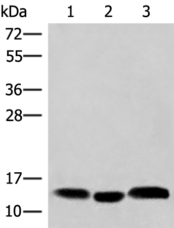 Western blot analysis of Human plasma solution Human placenta tissue Human gastric tissue lysates  using HBE1 Polyclonal Antibody at dilution of 1:200