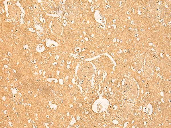 Immunohistochemistry of paraffin-embedded Human brain tissue  using RNASE4 Polyclonal Antibody at dilution of 1:45(×200)