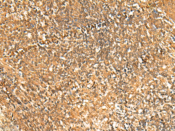 Immunohistochemistry of paraffin-embedded Human tonsil tissue  using GSG1L Polyclonal Antibody at dilution of 1:50(×200)