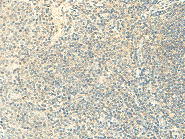 Immunohistochemistry of paraffin-embedded Human tonsil tissue  using FMNL2 Polyclonal Antibody at dilution of 1:50(×200)