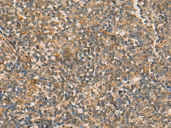 Immunohistochemistry of paraffin-embedded Human tonsil tissue  using IFT22 Polyclonal Antibody at dilution of 1:50(×200)