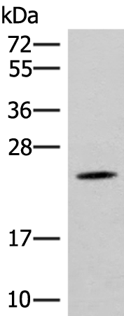 Western blot analysis of Mouse brain tissue lysate  using TBPL1 Polyclonal Antibody at dilution of 1:400