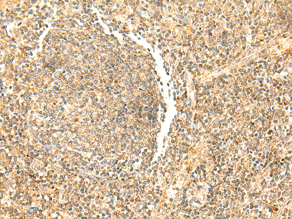 Immunohistochemistry of paraffin-embedded Human tonsil tissue  using DHFR Polyclonal Antibody at dilution of 1:50(×200)