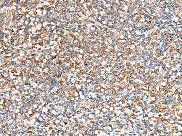 Immunohistochemistry of paraffin-embedded Human tonsil tissue  using SEC22B Polyclonal Antibody at dilution of 1:70(×200)