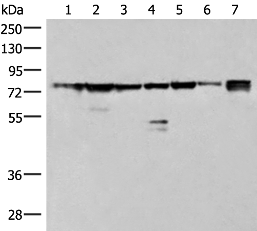 Western blot analysis of 231 K562 TM4 cell Mouse kidney tissue Mouse liver tissue Mouse brain tissue Hela cell lysates  using THNSL1 Polyclonal Antibody at dilution of 1:500