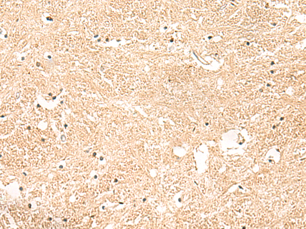 Immunohistochemistry of paraffin-embedded Human brain tissue  using GSTK1 Polyclonal Antibody at dilution of 1:50(×200)