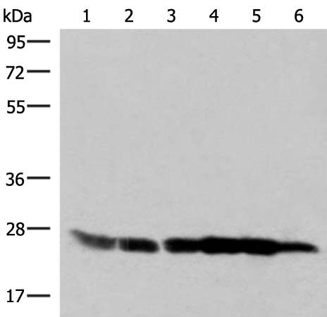 Western blot analysis of 293T HepG2 K562 HT29 A549 and Raji cell lysates  using GSTK1 Polyclonal Antibody at dilution of 1:250