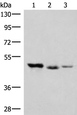 Western blot analysis of K562 and Jurkat cell Mouse kidney tissue lysates  using HMBOX1 Polyclonal Antibody at dilution of 1:500