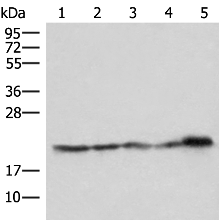 Western blot analysis of Hela HepG2 Jurkat and PC3 cell Mouse kidney tissue lysates  using ATP5PD Polyclonal Antibody at dilution of 1:550
