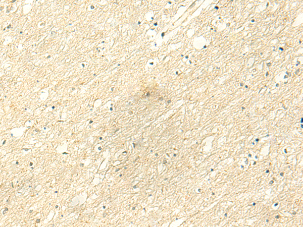 Immunohistochemistry of paraffin-embedded Human brain tissue  using POLR3F Polyclonal Antibody at dilution of 1:50(×200)