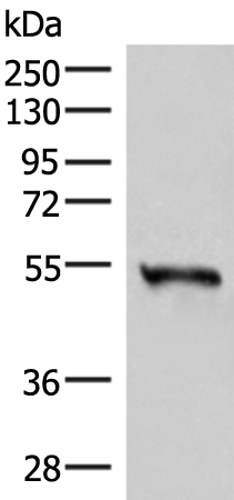 Western blot analysis of Human heart tissue lysate  using RETREG1 Polyclonal Antibody at dilution of 1:300