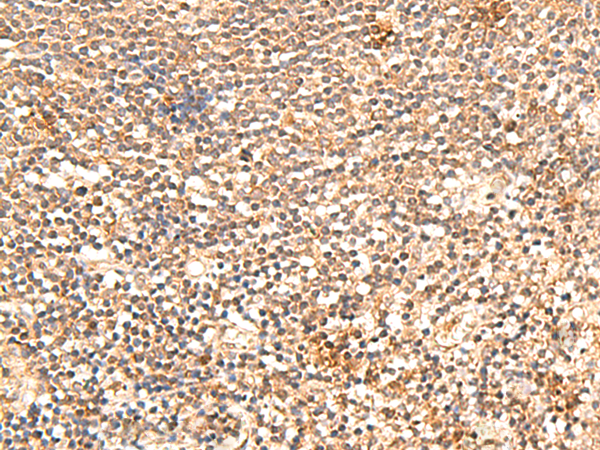 Immunohistochemistry of paraffin-embedded Human tonsil tissue  using TRAPPC1 Polyclonal Antibody at dilution of 1:60(×200)