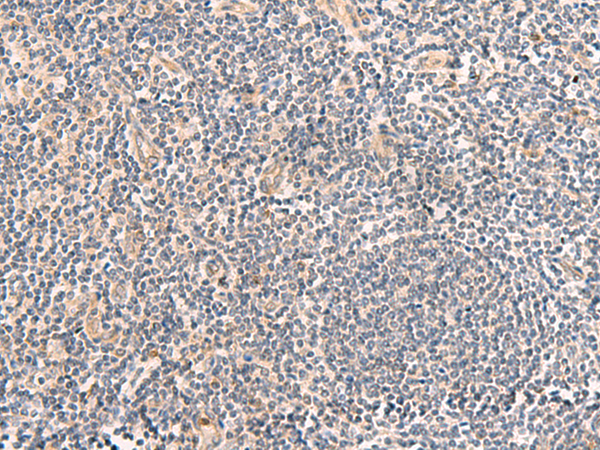 Immunohistochemistry of paraffin-embedded Human tonsil tissue  using TEAD3 Polyclonal Antibody at dilution of 1:50(×200)