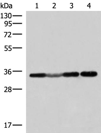 Western blot analysis of 293T and Hela cell Human fetal liver tissue lysates  using ECH1 Polyclonal Antibody at dilution of 1:300
