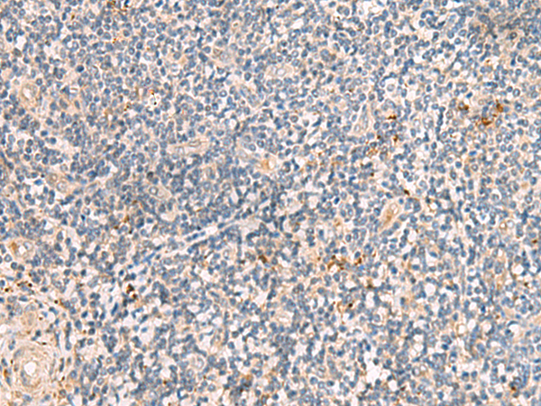 Immunohistochemistry of paraffin-embedded Human tonsil tissue  using MEST Polyclonal Antibody at dilution of 1:50(×200)