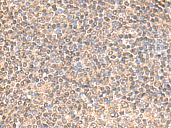 Immunohistochemistry of paraffin-embedded Human tonsil tissue  using IQCD Polyclonal Antibody at dilution of 1:60(×200)